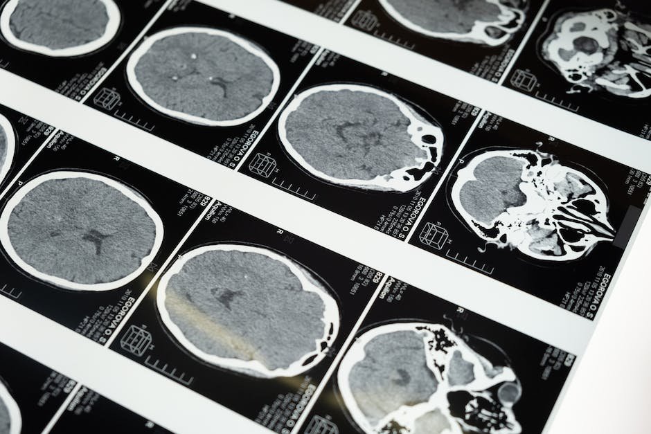 Image of a researcher examining brain scans related to autism research
